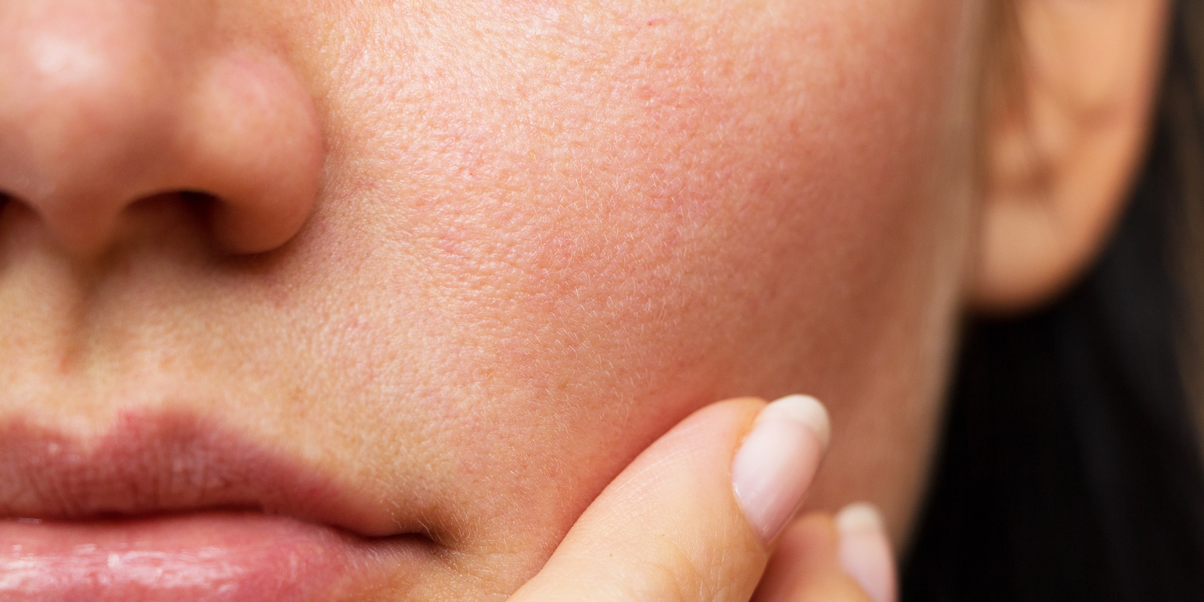 How To Get Rid Of Rough Skin On Face Home Remedies